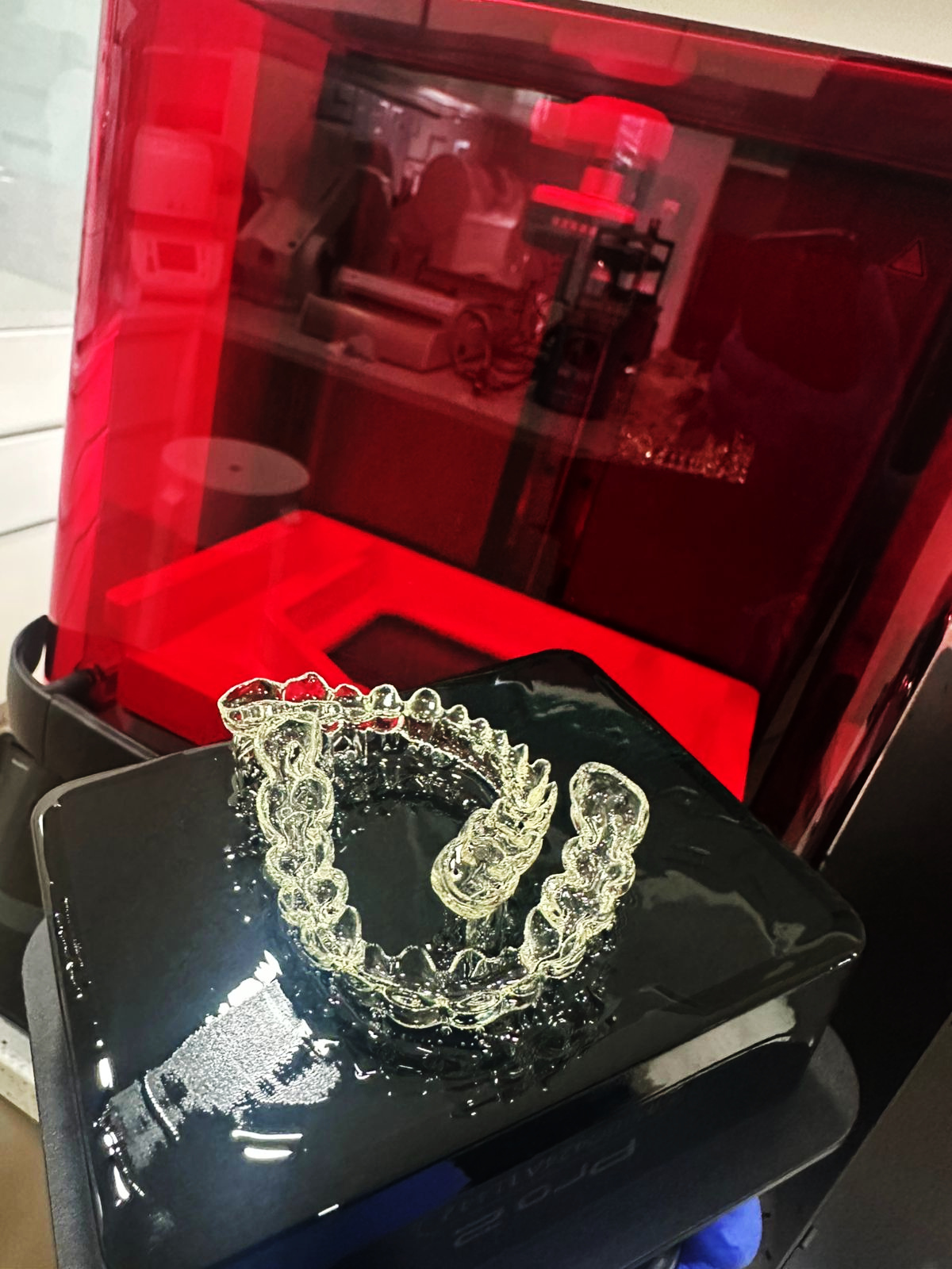 Clear Aligners